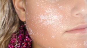 Which ingredients can help relieve dry skin?